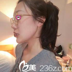 北京玲珑梵宫高春红注射瘦脸案例