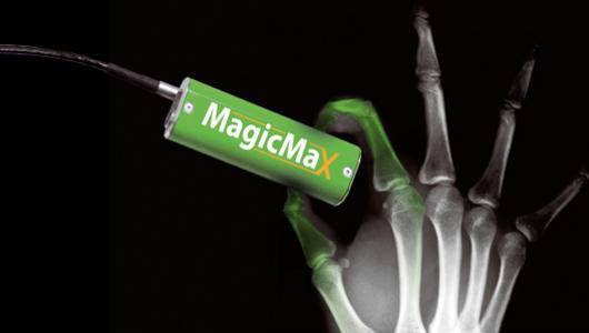 德国IBA公司Magic-MaX U型X-线输出评价系统X射线机多功能