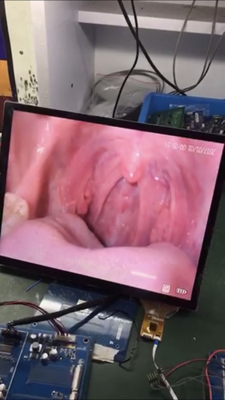 医疗工业内窥镜DVR视频显示模块